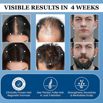 🔥 Thinning Hair? Roll On for Fuller-Looking Hair Fast