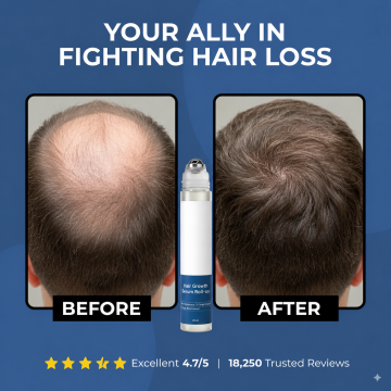 🔥 Thinning Hair? Roll On for Fuller-Looking Hair Fast