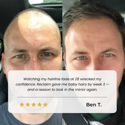 🔥 Thinning Hair? Roll On for Fuller-Looking Hair Fast