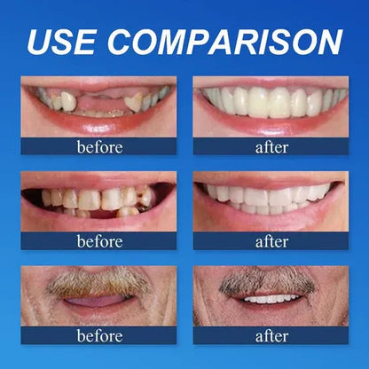🌎Ends Today: 50% OFF! ⏰KLENIMORE™ Custom-Fit — Designed for Comfort and a Natural-Looking Smile
