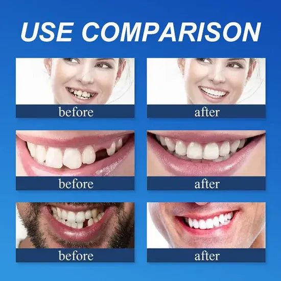 🌎Ends Today: 50% OFF! ⏰KLENIMORE™ Custom-Fit — Designed for Comfort and a Natural-Looking Smile
